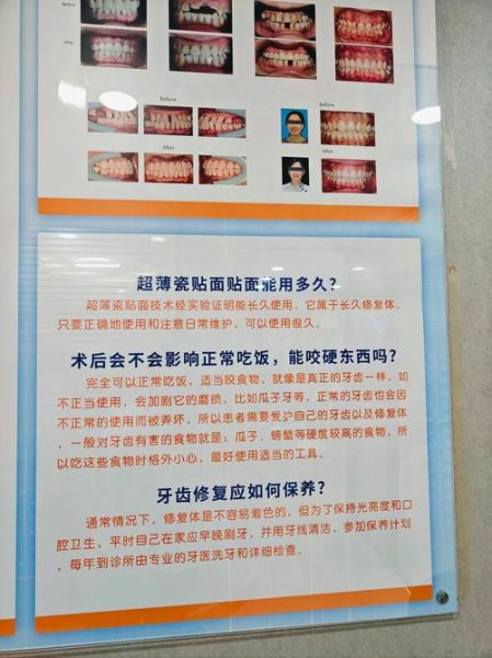 牙齿美学修复多少钱_牙齿美学修复能保持多久