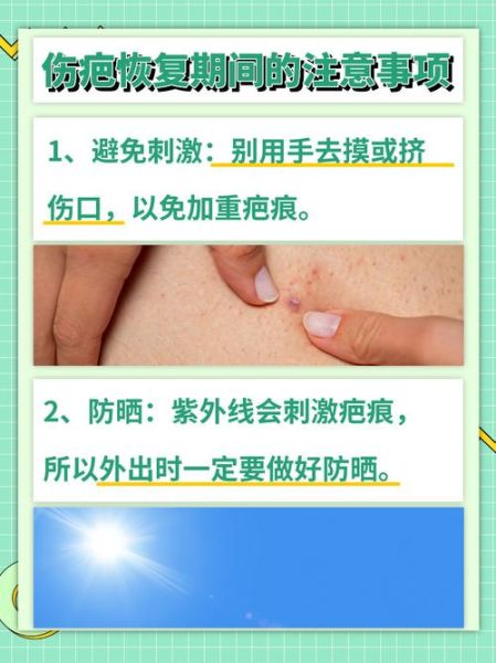 疤痕怎么淡化_疤痕修复最佳时间