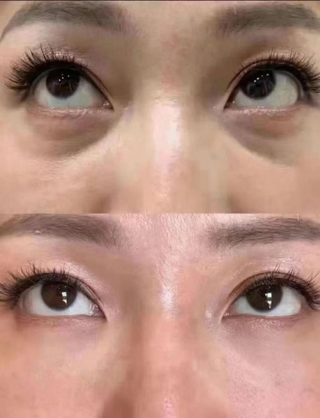 无痕科技是什么_无痕科技产品有哪些