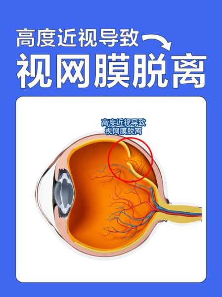 未来眼科黑科技有哪些_近视手术会消失吗